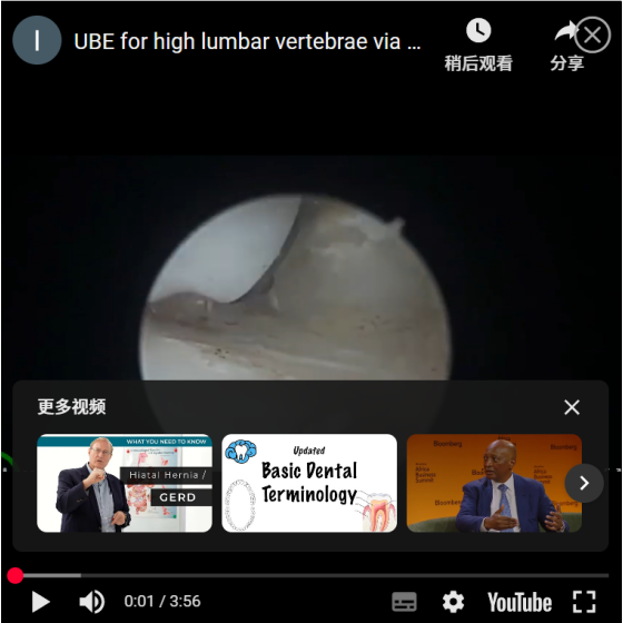 Eine UBE mit ärmeln geht durch die lamine: alles geht glatt